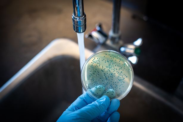 E coli bacteria culture plate held against running tap water (stock)