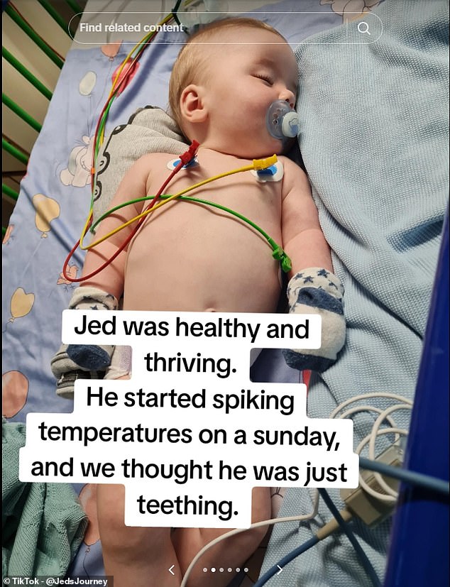 Little Jed Scanlon was just six months old when he was left brain damaged from the herpes virus