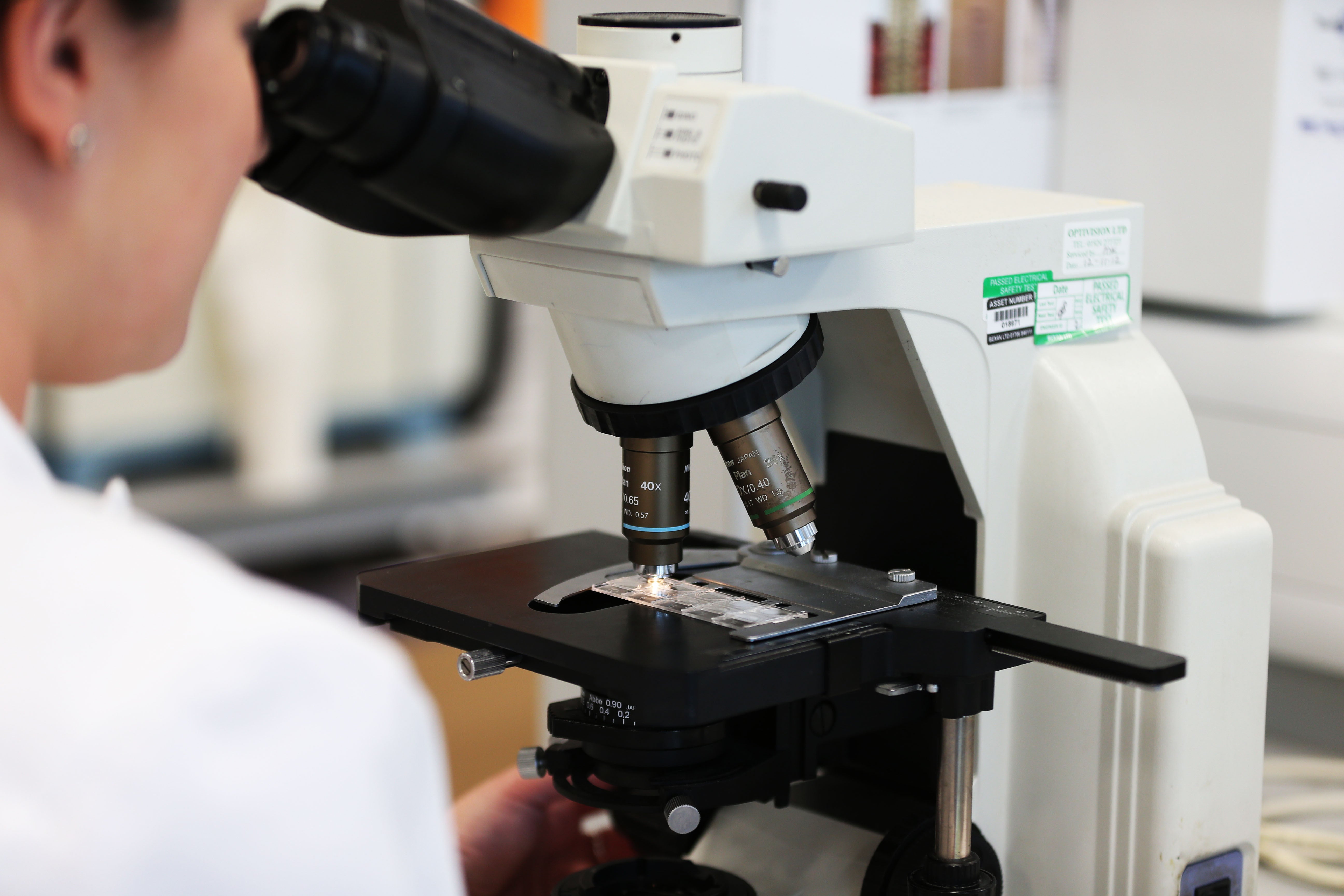 Typhoid fever is a bacterial infection that can cause serious and potentially fatal complications
